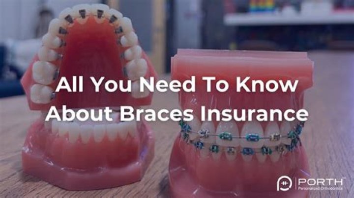 Do you have to pay for braces all at once?