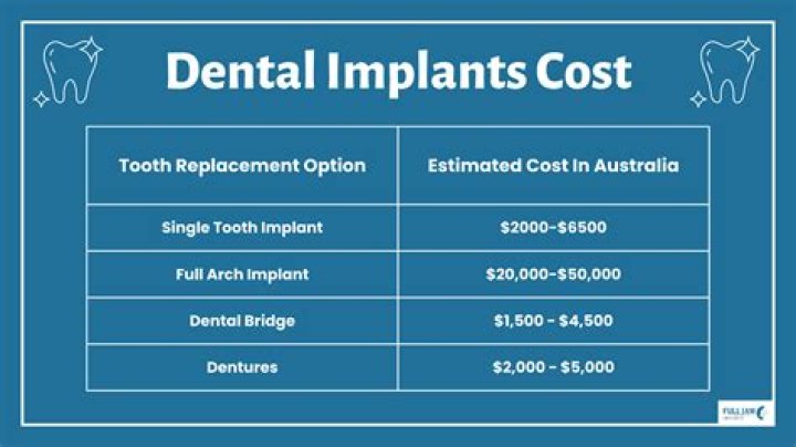 How much should a full set of dental implants cost?