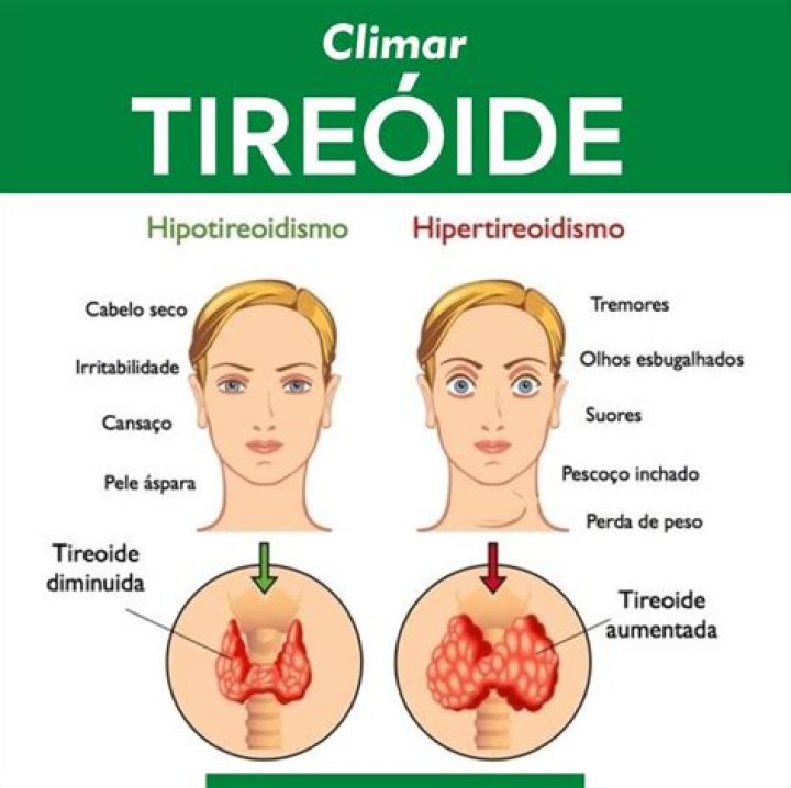 O que faz uma pessoa ter hipertireoidismo?