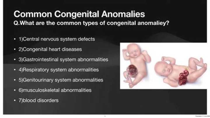 What causes multiple congenital anomalies?